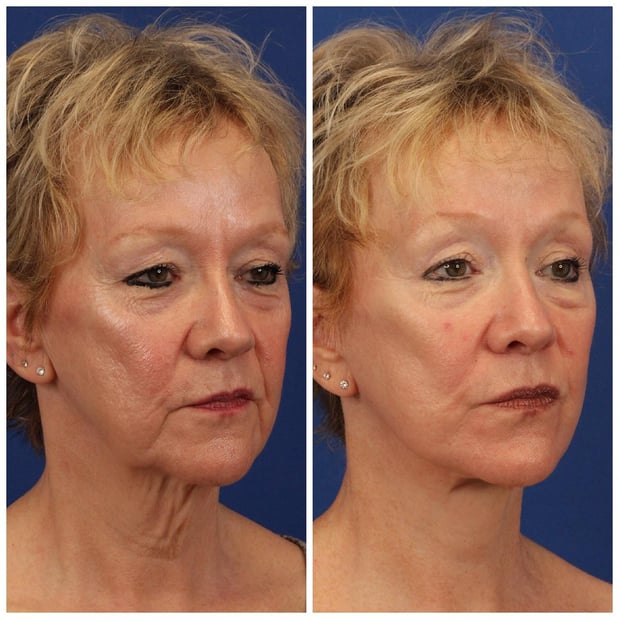 Images Dr. Sumit Bapna, MD