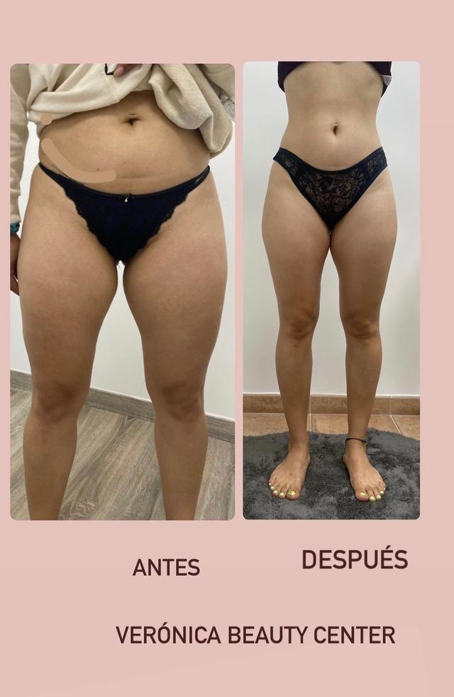 Images Verónica Beauty Center