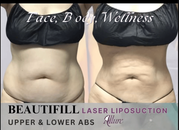 Images Allure Laser & Med Spa