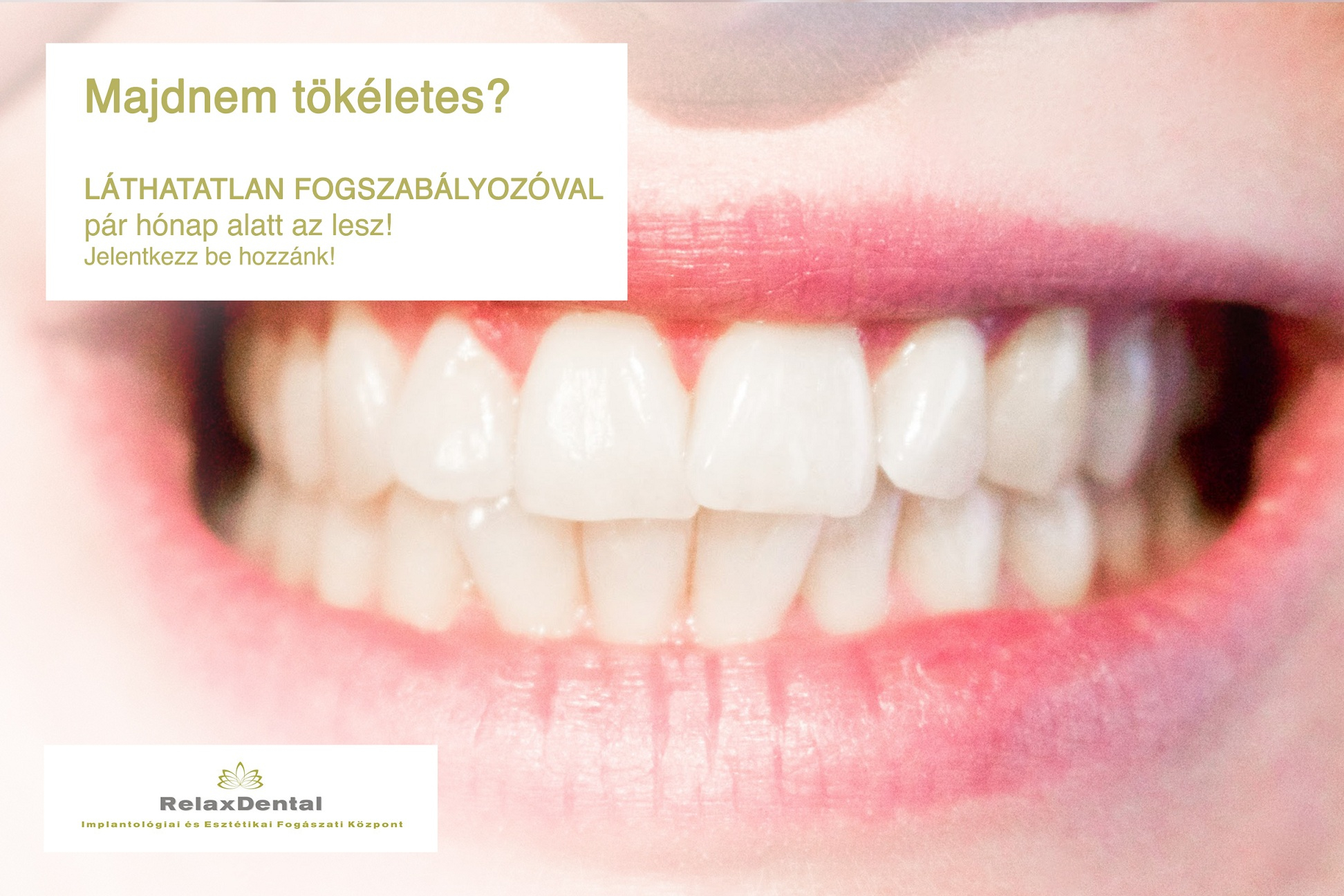 Images Relax Dental Implantológiai és Esztétikai Fogászati Központ