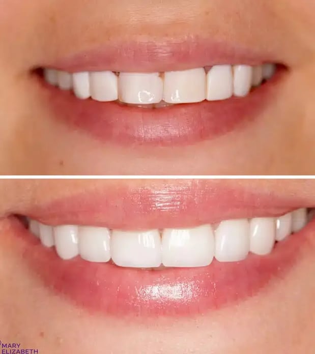 Images Mary Elizabeth Viechnicki, DMD