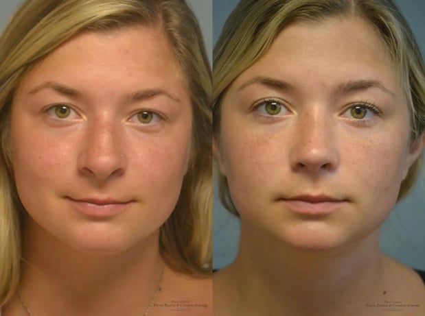 Images Providence Facial Plastic and Cosmetic Surgery
