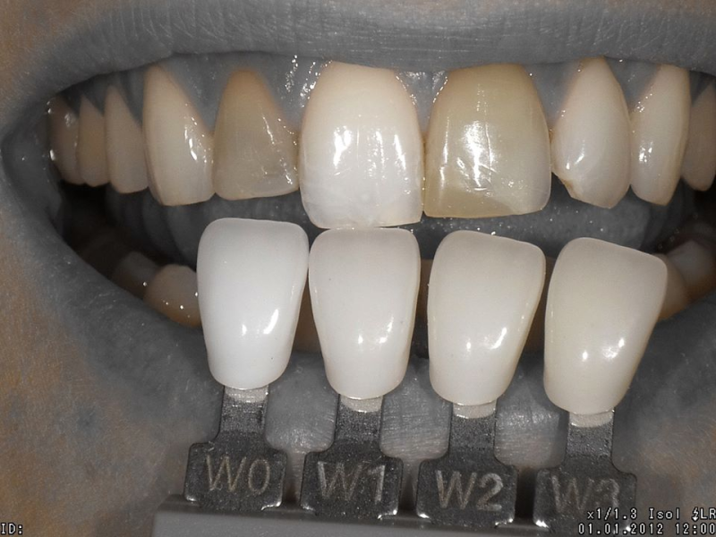 Images Studio Dentistico Prosper Dr. Loris
