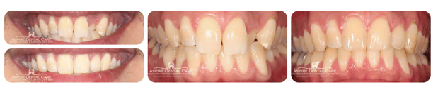 Images Aspire Dental Care PLLC