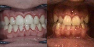 Images Haws Family Dentistry