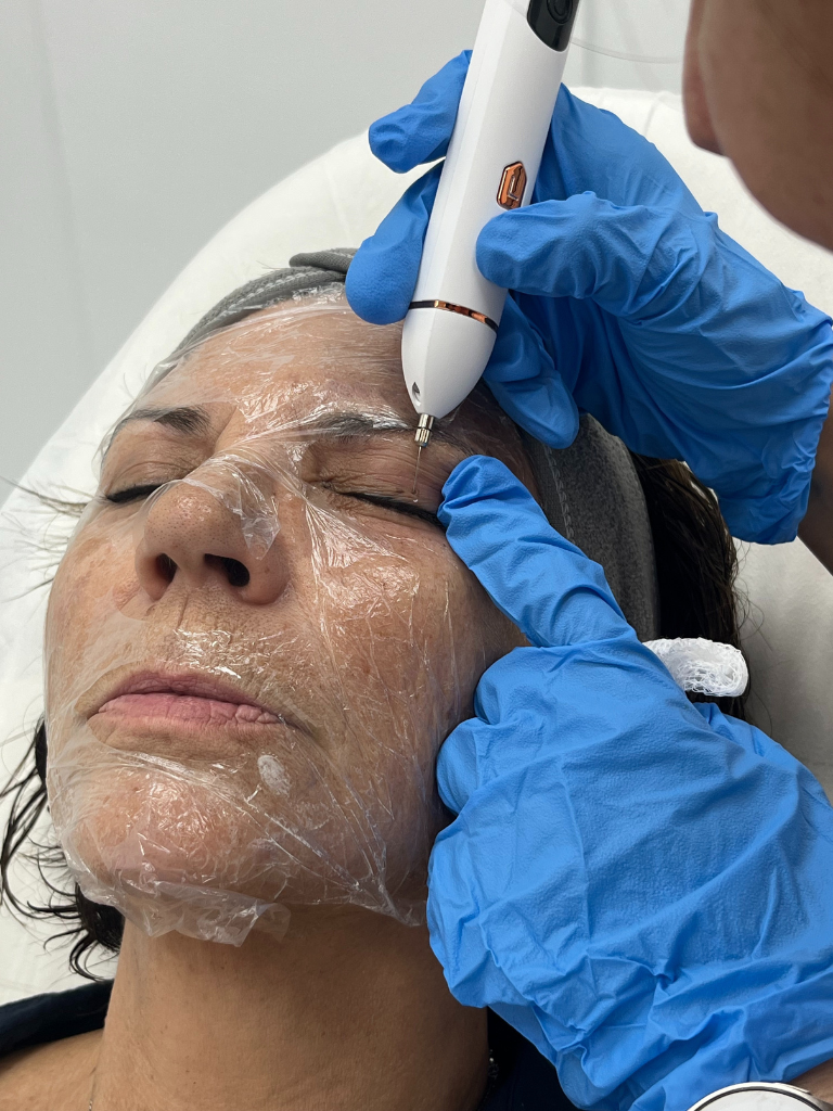 Images Dra. Silvia Solà. Medicina Estética y Láser