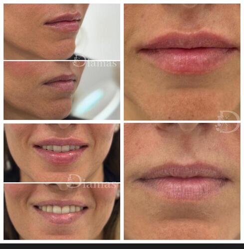 Images Clínica Estética Diamas