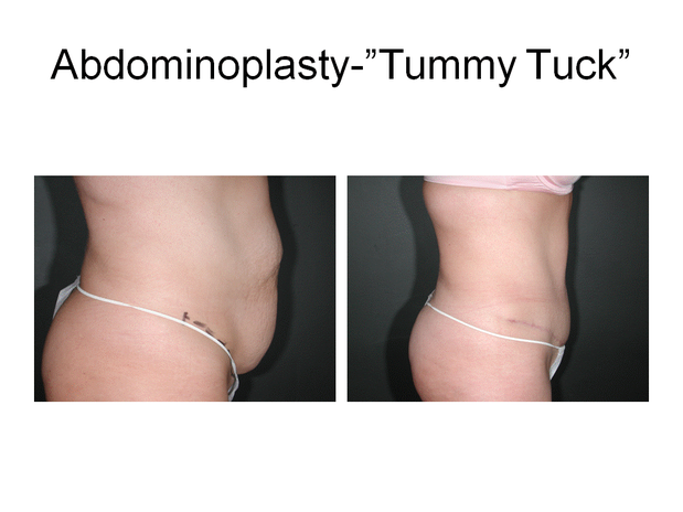 Images Dr. Joseph T. Chun, MD