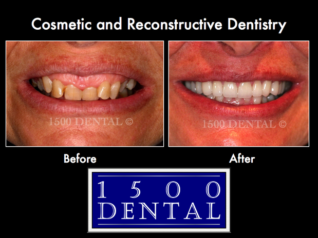 Images 1500 Dental