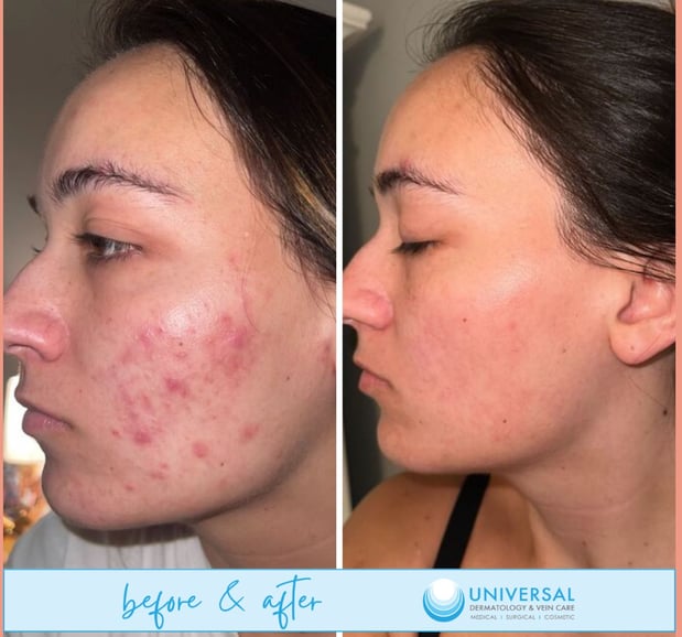 Images Universal Dermatology & Vein Care