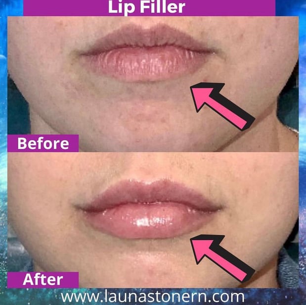 Images Launa Stone, R.N.