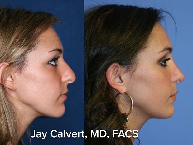 Images Jay Calvert, MD