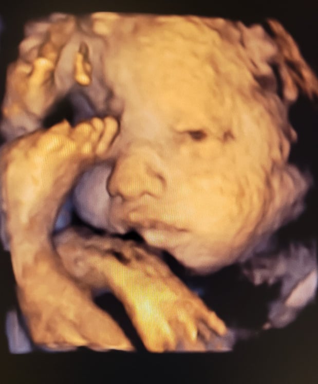Images Love At First Sight 3D/4D Ultrasound Imaging Studio, LLC