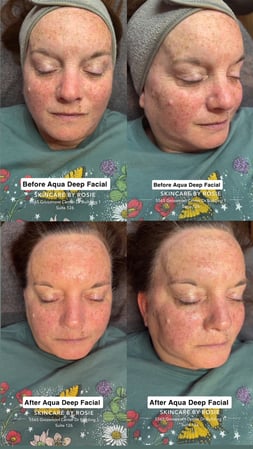 Images Skincare by Rosie