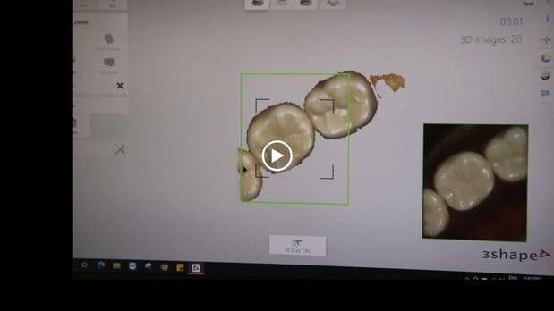 Images Broadview Dental Care | Glendale, CA
