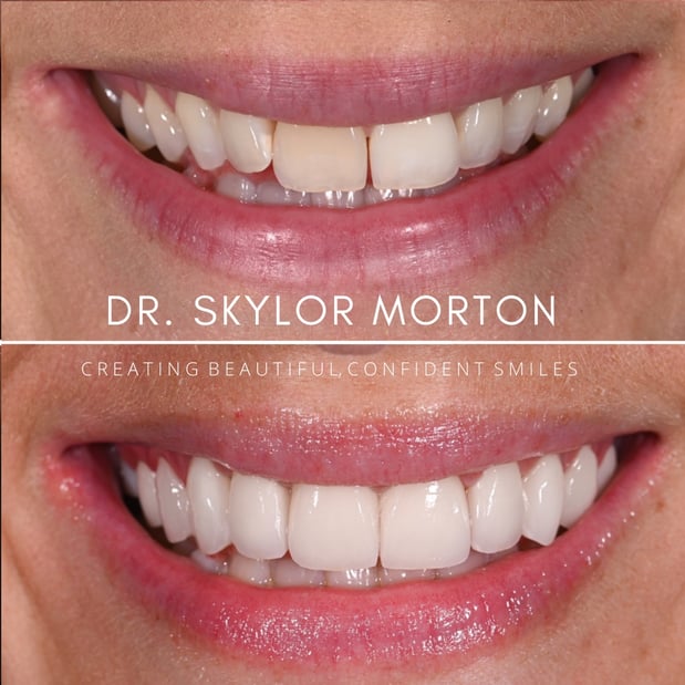 Images Nashville Wisdom Teeth and Implant Solutions
