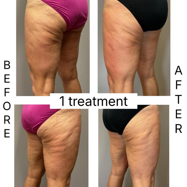 Images Sunkissed Med Spa