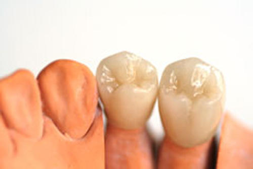 Zahnarztpraxis Pflug & Partner, Bastian Brockhusen, Neuengasse 28 in Biel/Bienne