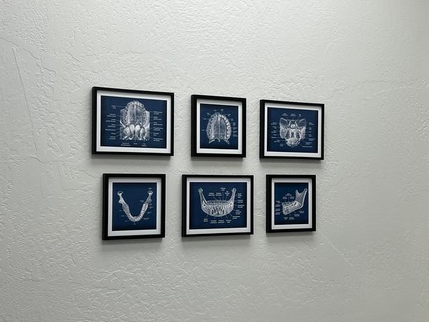 Images Mesa Dental Implants & Dentures
