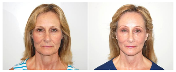 Images Newport Body: Richard H. Lee, MD