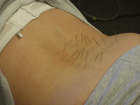 Images Dixon Chiropractic & Acupuncture