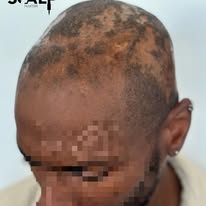 Images The Scalp Master