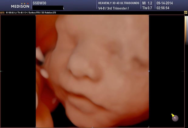 Images Heavenly 3D 4D Ultrasounds-Upland