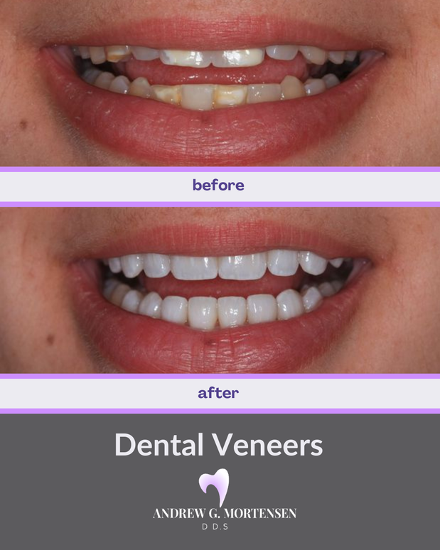 Images Andrew G. Mortensen, DDS