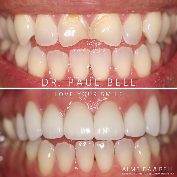Images Almeida & Bell Dental Lone Tree - General, Cosmetic, and Implant Dentistry