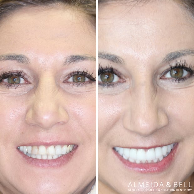 Images Almeida & Bell Dental Lone Tree - General, Cosmetic, and Implant Dentistry