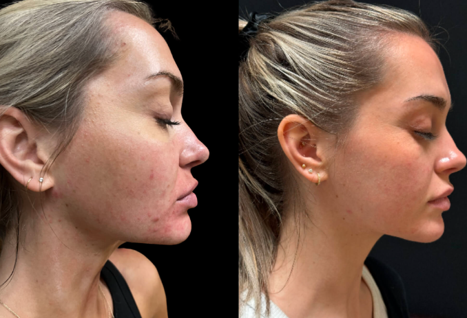 Images Finesse Cosmetic Surgery
