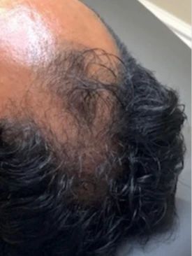 Images NovaStem Aesthetics