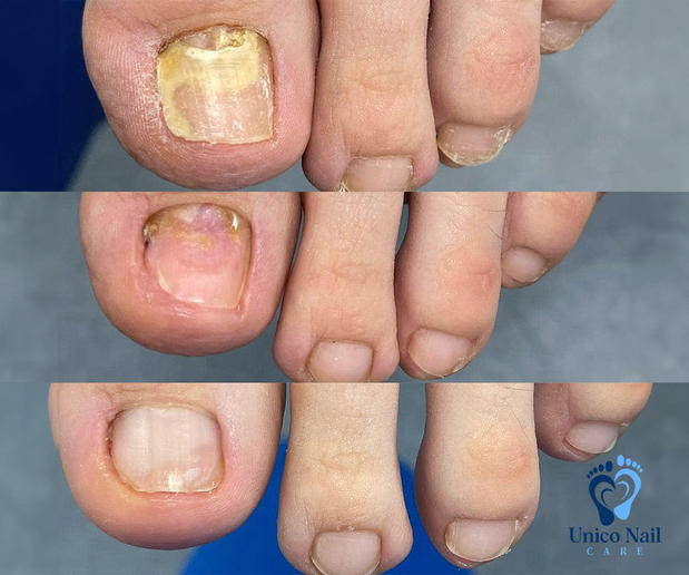 Images Unico Nail Care