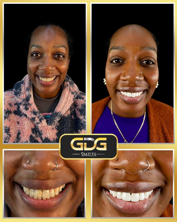 Images GDG Smiles