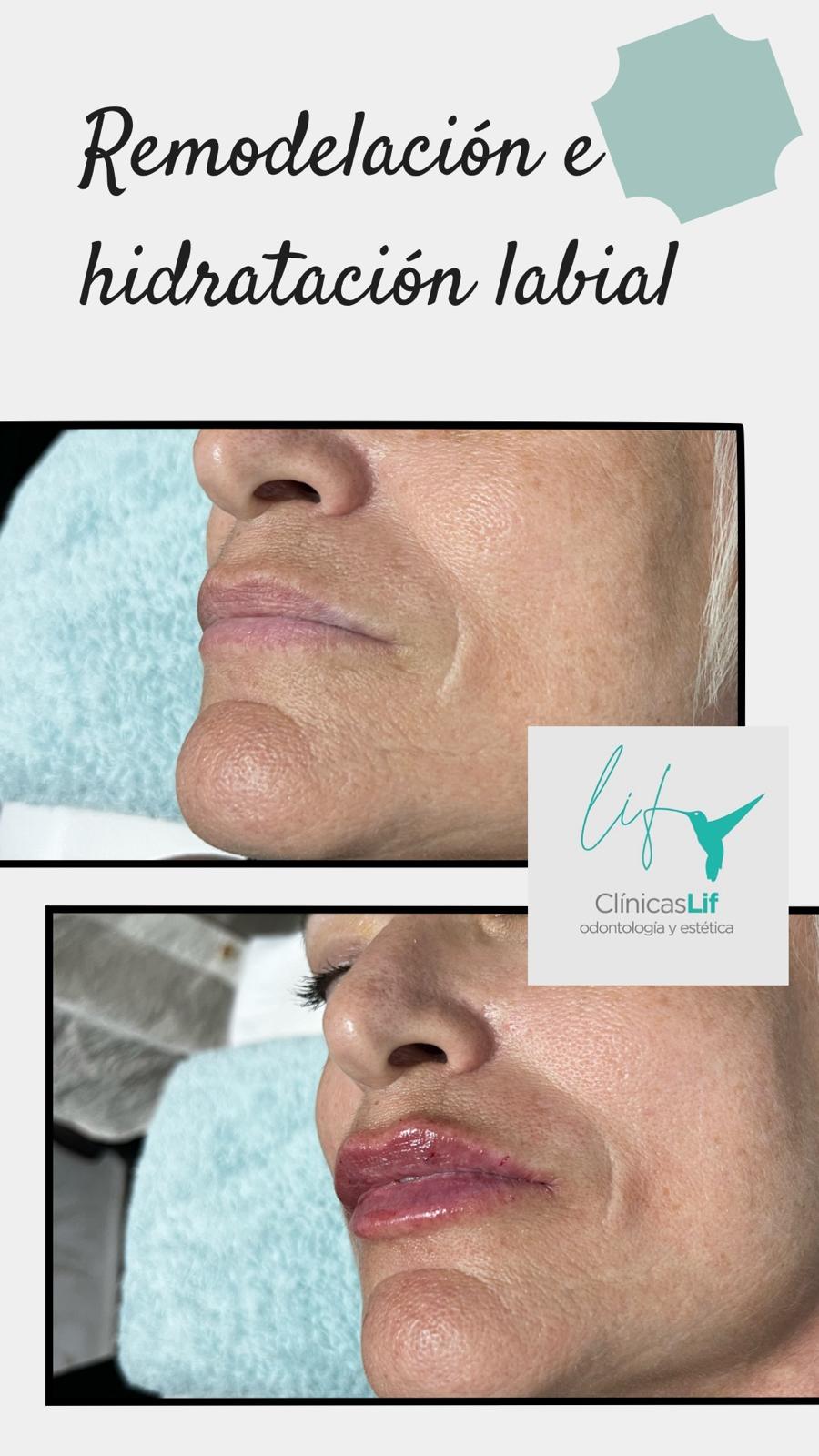 Images Clinicas Lif