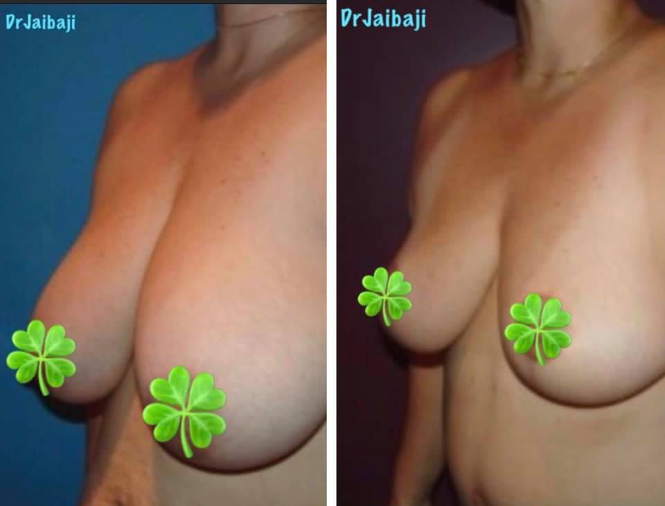 Jaibaji Plastic Surgery Photo