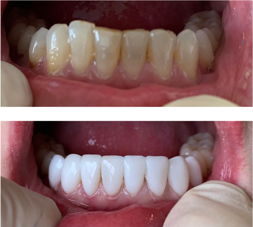 Blanchardstown Centre Dental Surgery (Orale Dental) 3