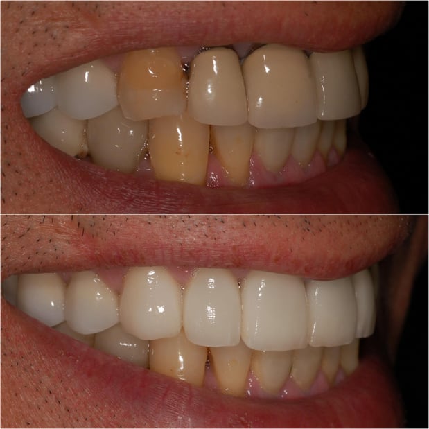 Images Pacific Dental Care