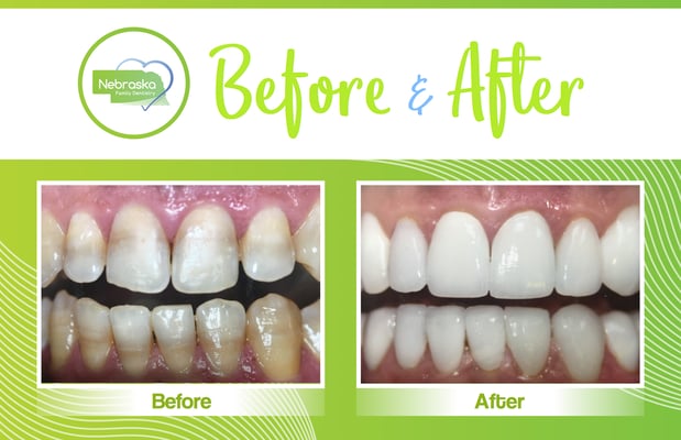 Images Lincoln Family Dentistry