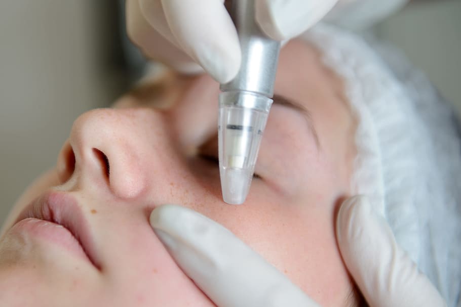 Images Innova Medic - Injections Botox, PRP, Agents de comblement, traitement des varices Longueuil