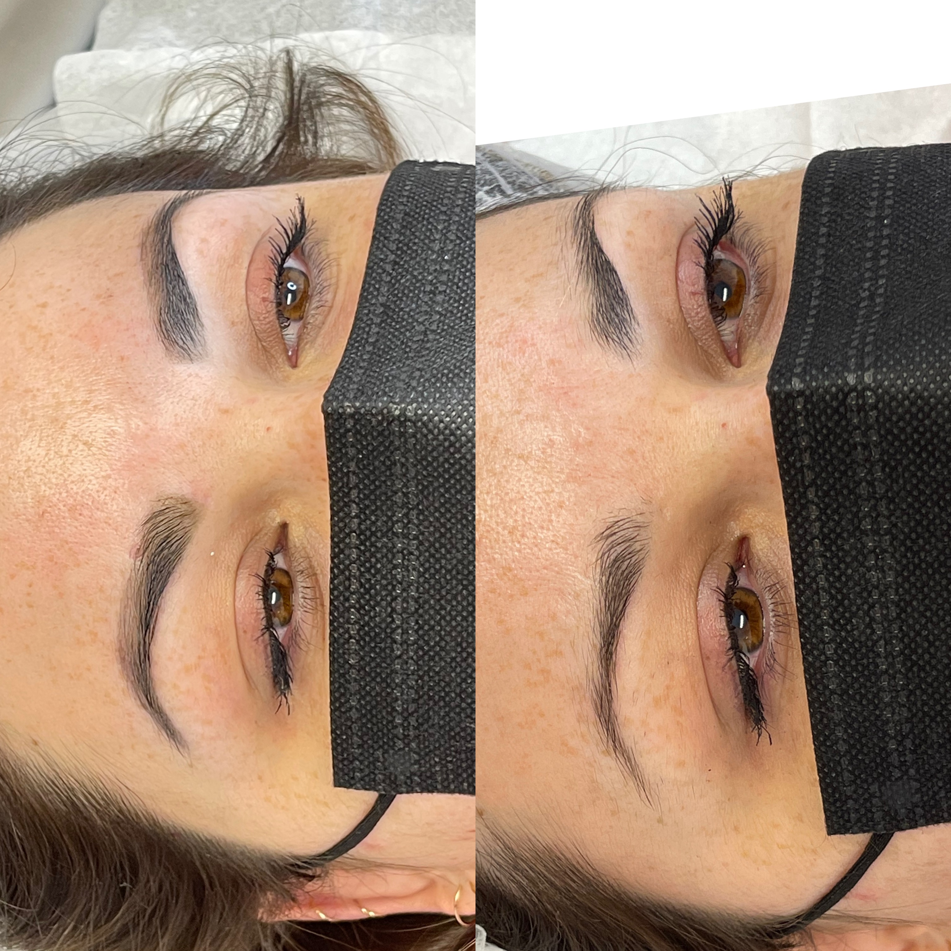 Images Clinique d'Esthétique Leila - Hydrafacial, Microblading, Épilation Laser Sainte-Foy