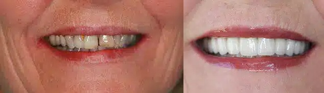 Dental Care of Jackson Hole Image