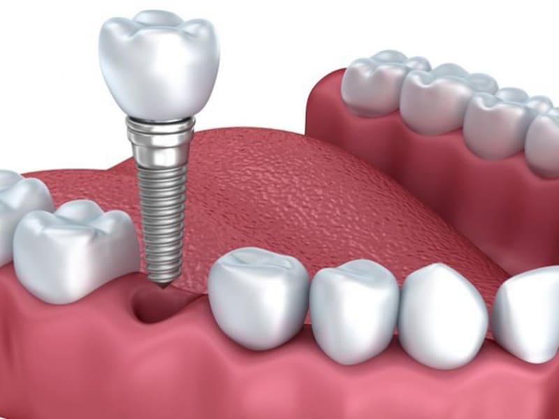 Images Dada Studi Dentistici