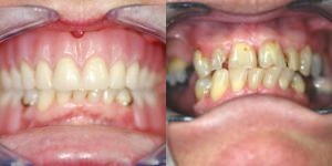 Images Haws Family Dentistry