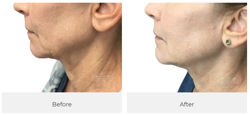 Castellano Cosmetic Surgery Center Image