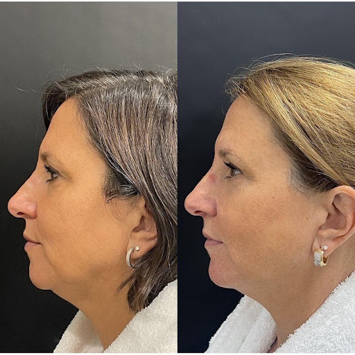 Dr Hani Sinno Chirurgien Esthétique | Plastic Surgeon Westmount