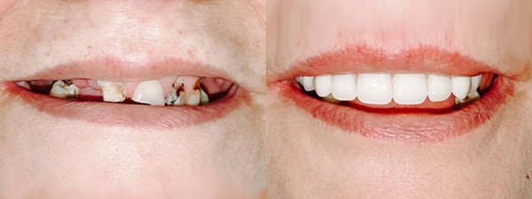 Images Riverside Family Dental