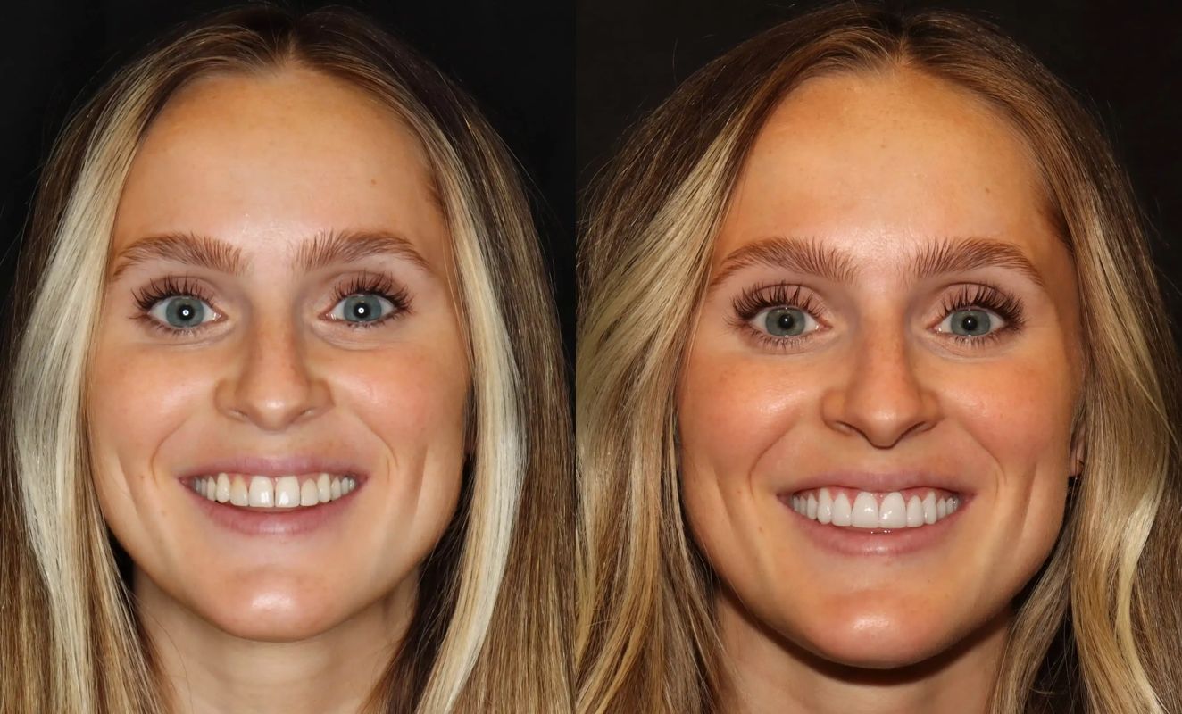 Intermountain Smiles Image