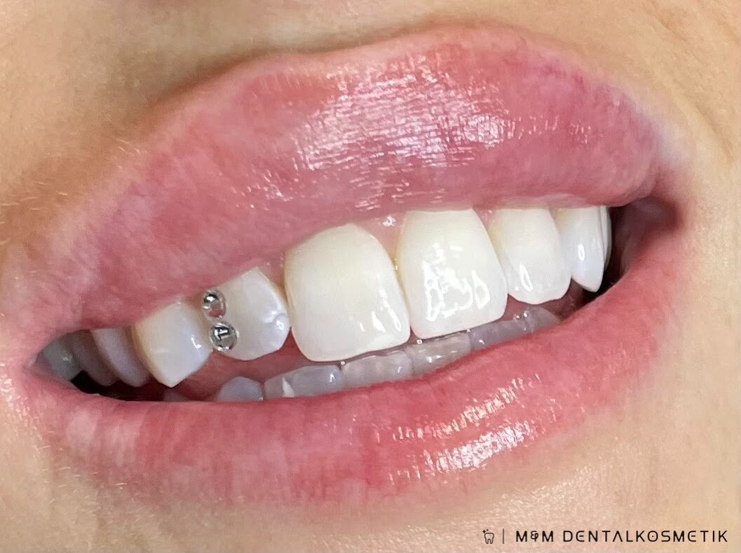 M&M Dental Beauty, Eichendorffstraße 70 in Pfullingen