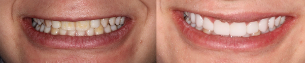 Images Cosmetic and Implant Dentistry of Connecticut